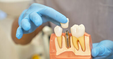 implante dental