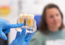 Implantes dentales en las Águilas Madrid