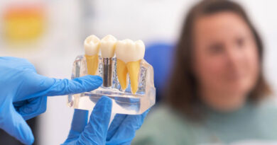 Implantes dentales en las Águilas Madrid