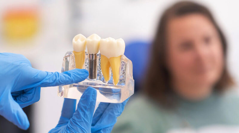 Implantes dentales en las Águilas Madrid